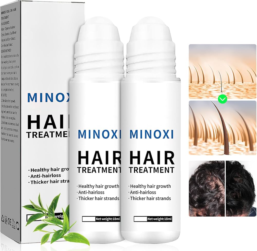 Minoxidil hair treatment bottles with packaging and images of hair growth.