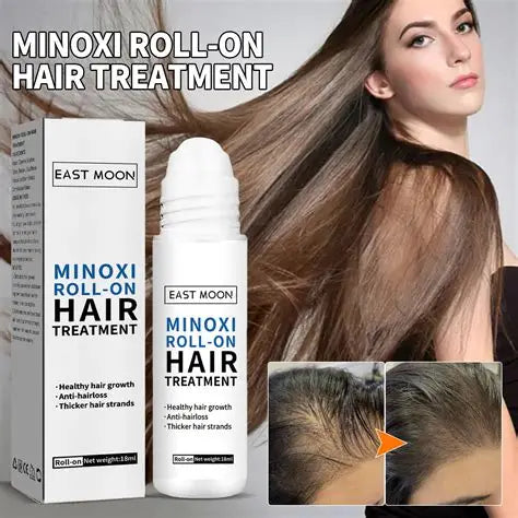 Minoxidil roll-on hair treatment with packaging and before-and-after comparison on a woman's hair.