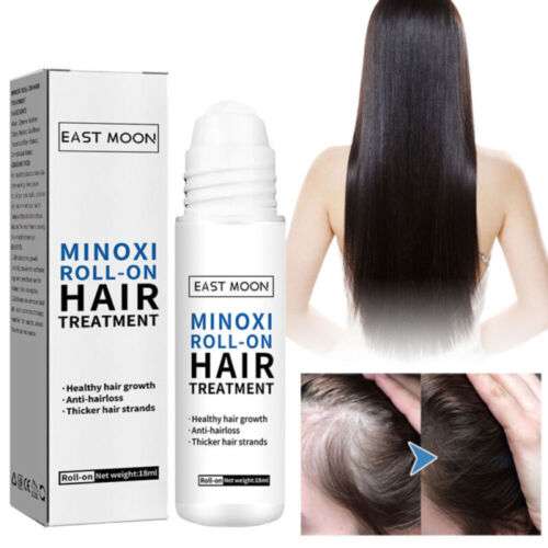Minoxidil roll-on hair treatment with packaging and before-and-after images on a white background